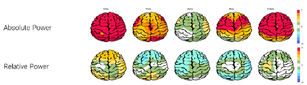 رنگ قرمز در نقشه مغزی نشانه چیست؟