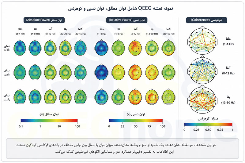 نمونه نقشه QEEG شامل توان مطلق، توان نسبی و کوهرنس در باندهای فرکانسی مختلف